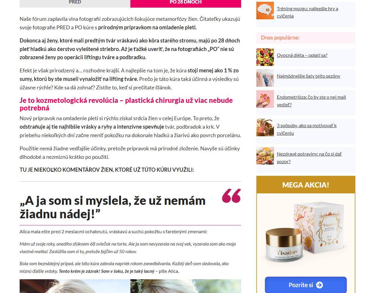 Visadore 2